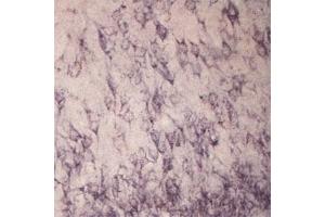 IHC on rat brain using Rabbit antibody to extracellular, N-terminal part of Sortilin (Neurotensin receptor 3, NTR3, Sort1): IgG  at a concentration of 10 µg/ml. (Sortilin 1 抗体)