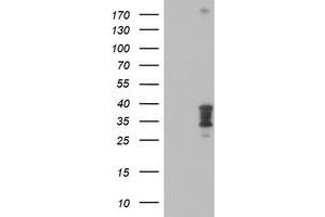 Western Blotting (WB) image for anti-Homeobox C11 (HOXC11) (AA 1-304) antibody (ABIN1490735) (HOXC11 抗体  (AA 1-304))
