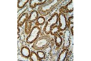 Immunohistochemistry (Paraffin-embedded Sections) (IHC (p)) image for anti-NADH Dehydrogenase (Ubiquinone) 1, Subcomplex Unknown, 2, 14.5kDa (NDUFC2) (AA 93-123), (C-Term) antibody (ABIN953635)