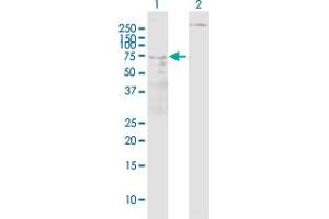 Western Blot analysis of ALOX5 expression in transfected 293T cell line ( H00000240-T01 ) by ALOX5 MaxPab polyclonal antibody. (ALOX5 抗体  (AA 1-674))