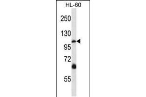 Western blot analysis in HL-60 cell line lysates (35ug/lane). (TRPC5 抗体  (N-Term))