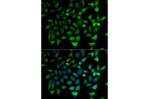 Immunofluorescence analysis of HeLa cells using SLC25A20 antibody (ABIN5974144). (SLC25A20 抗体)