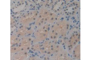 IHC-P analysis of kidney tissue, with DAB staining. (CDK2AP1 抗体  (AA 1-115))