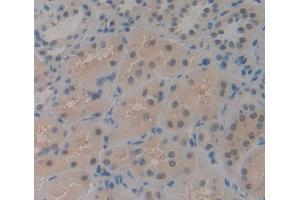 IHC-P analysis of kidney tissue, with DAB staining. (CDK2AP1 抗体  (AA 1-115))