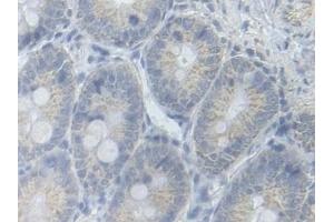 Detection of PFKM in Rat Colon Tissue using Polyclonal Antibody to Phosphofructokinase, Muscle (PFKM) (PFKM 抗体  (AA 2-390))
