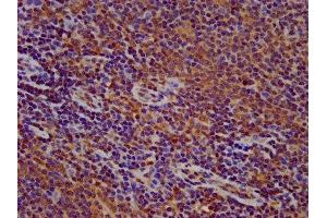 IHC image of ABIN7165598 diluted at 1:500 and staining in paraffin-embedded human lymph node tissue performed on a Leica BondTM system. (FLII 抗体  (AA 577-729))