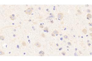 Detection of MXRA5 in Human Cerebrum Tissue using Polyclonal Antibody to Matrix Remodelling Associated Protein 5 (MXRA5) (Matrix Remodelling Associated Protein 5 (AA 2542-2828) 抗体)