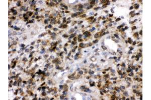 Anti- PGP9. (UCHL1 抗体  (C-Term))