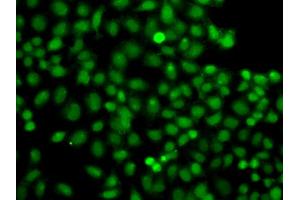 Immunofluorescence analysis of A549 cells using PIP5K1A antibody (ABIN6292233). (PIP5K1A 抗体)