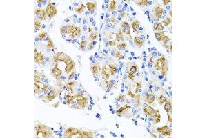 Immunohistochemistry of paraffin-embedded human gastric using FECH antibody at dilution of 1:100 (x40 lens). (FECH 抗体)