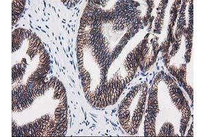 Image no. 1 for anti-Catenin (Cadherin-Associated Protein), beta 1, 88kDa (CTNNB1) antibody (ABIN1496893) (CTNNB1 抗体)