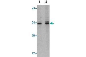 Western blot analysis of HepG2 cells with RSRC1 polyclonal antibody  at (Lane 1) 1 and (Lane 2) 2 ug/mL dilution. (RSRC1 抗体  (C-Term))