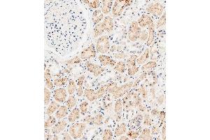 Immunohistochemistry (Paraffin-embedded Sections) (IHC (p)) image for anti-Solute Carrier Family 47, Member 1 (SLC47A1) (AA 492-519), (C-Term) antibody (ABIN651547)