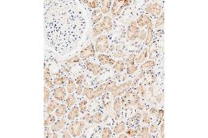 Immunohistochemical analysis of paraffin-embedded human kidney tissue using (ABIN651547 and ABIN2840295) performed on the Leica® BOND RXm. (SLC47A1 抗体  (C-Term))