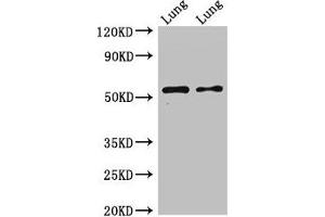 Western Blot Positive WB detected in: Rat lung tissue, Mouse lung tissue All lanes: HTR3A antibody at 2. (Serotonin Receptor 3A 抗体  (AA 322-455))