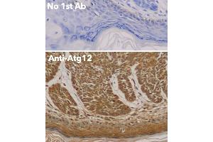 Immunohistochemistry (IHC) image for anti-Autophagy Related 12 (ATG12) (N-Term) antibody (ABIN6254241) (ATG12 抗体  (N-Term))