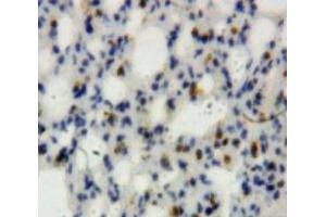 #VALUE! (Lipocalin 2 抗体  (AA 21-200))