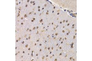 Immunohistochemistry of paraffin-embedded mouse brain using RAD1 antibody (ABIN6290854) at dilution of 1:200 (40x lens). (RAD1 抗体)