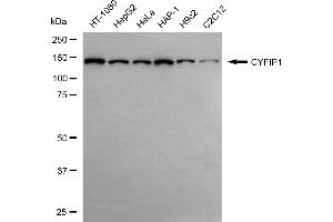anti-Cytoplasmic FMR1 Interacting Protein 1 (CYFIP1) antibody