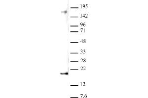 Histone H3 dimethyl Lys27 antibody (pAb) tested by Western blot. (Histone 3 抗体  (2meLys27))