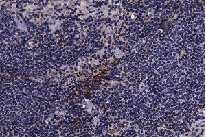 ABIN6267639 at 1/200 staining human lymph node tissue sections by IHC-P. (PIN1 抗体  (pSer16))