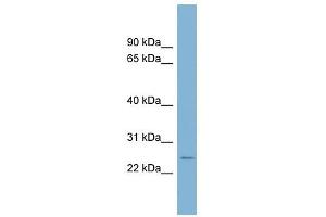 CD160 antibody used at 1 ug/ml to detect target protein. (CD160 抗体  (Middle Region))