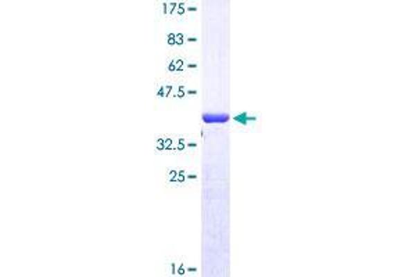 RNF146 Protein (AA 1-110) (GST tag)