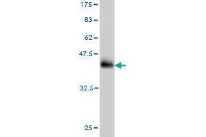 Western Blot detection against Immunogen (37. (NSDHL 抗体  (AA 1-110))