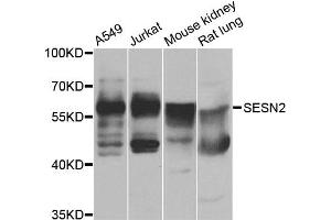 Western blot analysis of extracts of various cell lines, using SESN2 antibody (ABIN4905132) at 1:1000 dilution. (Sestrin 2 抗体)