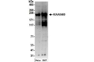anti-Regulation of Nuclear Pre-mRNA Domain Containing 2 (RPRD2) (AA 700-750) antibody