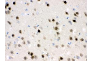 Anti- HDAC11 Picoband antibody,IHC(P) IHC(P): Mouse Brain Tissue (HDAC11 抗体  (N-Term))