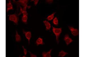 Immunofluorescence (fixed cells) (IF/ICC) image for anti-Activating Transcription Factor 2 (ATF2) (pThr51), (pThr69) antibody (ABIN6256594)