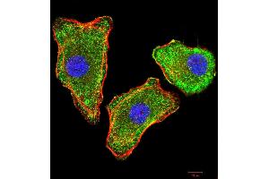 Immunocytochemistry (ICC) image for anti-Transthyretin (TTR) (AA 1-147) antibody (ABIN5875576) (TTR 抗体  (AA 1-147))