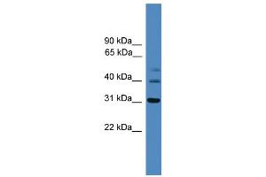 WB Suggested Anti-TRIB1  Antibody Titration: 0. (TRIB1 抗体  (C-Term))
