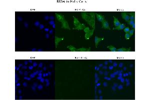 Sample Type :  HeLa   Primary Antibody Dilution:  4 ug/ml   Secondary Antibody :  Anti-rabbit Alexa 546   Secondary Antibody Dilution:  2 ug/ml   Gene Name :  BRD4 (BRD4 抗体  (C-Term))