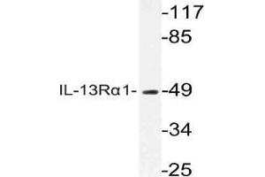 Western blot analysis of CD213a1 / IL13RA1 Antibody in extracts from COLOcells. (IL13 Receptor alpha 1 抗体)