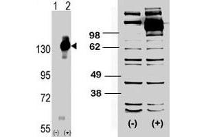(LEFT) Western blot analysis of CSF1R (arrow) using rabbit CSF1R polyclonal antibody .