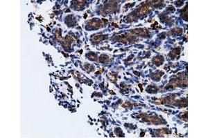Immunohistochemical staining of paraffin-embedded Human breast tissue using anti-KHK mouse monoclonal antibody. (Ketohexokinase 抗体)
