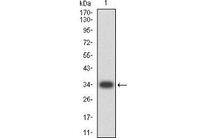 Western blot analysis using CD268 mAb against human CD268 (AA: extra 1-78) recombinant protein. (TNFRSF13C 抗体  (AA 1-78))