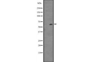 Western blot analysis of Cytochrome P450 4F12 expression in NCI-H460 cell line lysates ,The lane on the left is treated with the antigen-specific peptide. (CYP4F12 抗体)