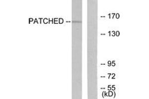 Western blot analysis of extracts from mouse muscle cells, using Patched Antibody. (Patched 1 抗体  (AA 1-50))
