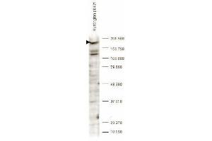 Western blot analysis is shown using anti-Huntingtin pS421 antibody to detect endogenous protein present in an unstimulated human PC-3 whole cell lysate (arrowhead). (Huntingtin 抗体  (pSer421))
