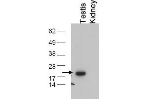 Image no. 1 for anti-Glutathione Peroxidase 4 (GPX4) (C-Term) antibody (ABIN401375) (GPX4 抗体  (C-Term))
