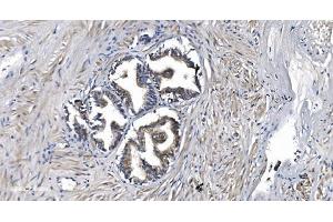 IHC analysis of STIL/SIL using anti-STIL/SIL antibody (ABIN7599923). (STIL 抗体  (AA 13-1287))
