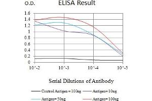 Black line: Control Antigen (100 ng),Purple line: Antigen (10 ng), Blue line: Antigen (50 ng), Red line:Antigen (100 ng) (IL15RA 抗体  (AA 31-205))