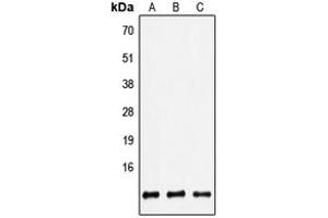 Western blot analysis of Defensin beta 2 expression in HEK293T (A), Raw264. (beta 2 Defensin 抗体  (Center))