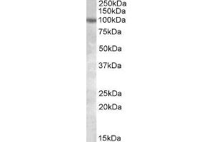 ABIN2564625 (1µg/ml) staining of HeLa lysate (35µg protein in RIPA buffer). (PKD2 抗体  (Internal Region))