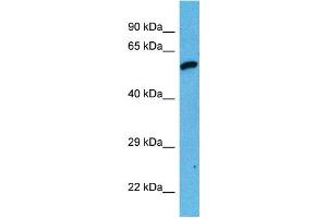 Host:  Mouse  Target Name:  DES  Sample Tissue:  Mouse Testis  Antibody Dilution:  1ug/ml (Desmin 抗体  (Middle Region))