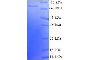 LCK Protein (AA 1-539, Isoform 3) (His-SUMO Tag)