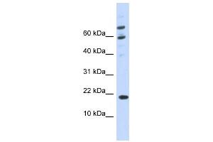 Western Blotting (WB) image for anti-BRWD1-AS2 antibody (ABIN2458959) (BRWD1-AS2 抗体)